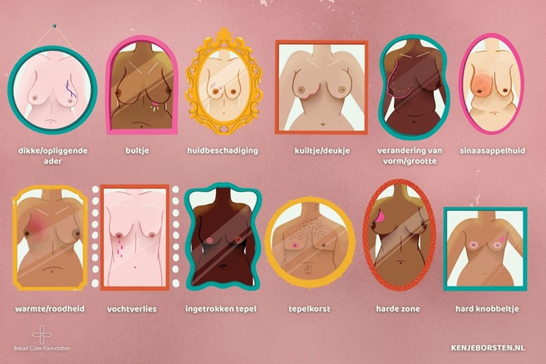 Mogelijke kenmerken van borstkanker